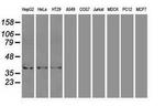 ICAD Antibody in Western Blot (WB)