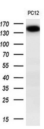 TRPM4 Antibody in Western Blot (WB)