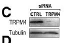 TRPM4 Antibody in Western Blot (WB)