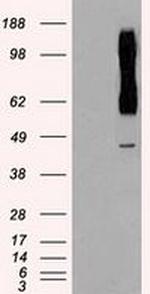 RAD9 Antibody in Western Blot (WB)