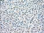 RAD9 Antibody in Immunohistochemistry (Paraffin) (IHC (P))