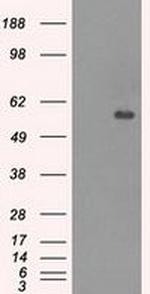 CNDP1 Antibody in Western Blot (WB)