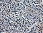 Kindlin 2 Antibody in Immunohistochemistry (Paraffin) (IHC (P))