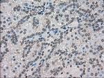 Kindlin 2 Antibody in Immunohistochemistry (Paraffin) (IHC (P))