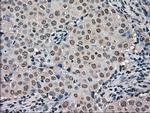 Kindlin 2 Antibody in Immunohistochemistry (Paraffin) (IHC (P))