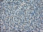 Kindlin 2 Antibody in Immunohistochemistry (Paraffin) (IHC (P))