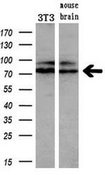 Kindlin 2 Antibody in Western Blot (WB)