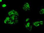 Kindlin 2 Antibody in Immunocytochemistry (ICC/IF)