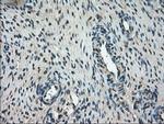 Kindlin 2 Antibody in Immunohistochemistry (Paraffin) (IHC (P))