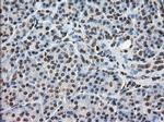 DHFR Antibody in Immunohistochemistry (Paraffin) (IHC (P))