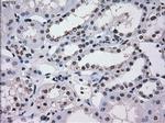 SATB1 Antibody in Immunohistochemistry (Paraffin) (IHC (P))