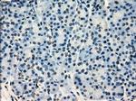 SATB1 Antibody in Immunohistochemistry (Paraffin) (IHC (P))