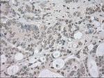 NEK6 Antibody in Immunohistochemistry (Paraffin) (IHC (P))