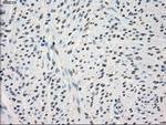 PP5 Antibody in Immunohistochemistry (Paraffin) (IHC (P))