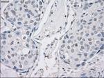 PP5 Antibody in Immunohistochemistry (Paraffin) (IHC (P))