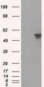 PP5 Antibody in Western Blot (WB)