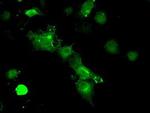 PP5 Antibody in Immunocytochemistry (ICC/IF)