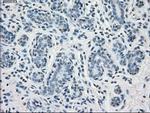 PP5 Antibody in Immunohistochemistry (Paraffin) (IHC (P))