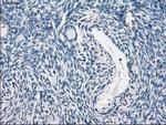 PP5 Antibody in Immunohistochemistry (Paraffin) (IHC (P))