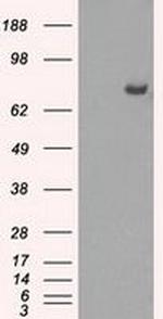 Cytochrome P450 Reductase Antibody in Western Blot (WB)