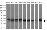 ZFP36 Antibody in Western Blot (WB)