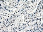 Fra1 Antibody in Immunohistochemistry (Paraffin) (IHC (P))