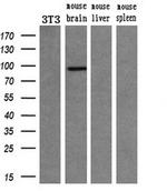 PDE10A Antibody in Western Blot (WB)