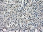 Cytochrome P450 Reductase Antibody in Immunohistochemistry (Paraffin) (IHC (P))