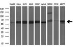 SLC2A6 Antibody in Western Blot (WB)