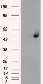 SLC2A6 Antibody in Western Blot (WB)