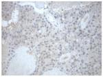 PRKAR1A Antibody in Immunohistochemistry (Paraffin) (IHC (P))