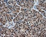 LTA4H Antibody in Immunohistochemistry (Paraffin) (IHC (P))