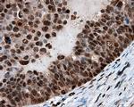 LTA4H Antibody in Immunohistochemistry (Paraffin) (IHC (P))