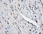 LTA4H Antibody in Immunohistochemistry (Paraffin) (IHC (P))