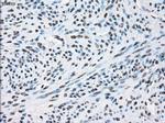 XRCC4 Antibody in Immunohistochemistry (Paraffin) (IHC (P))