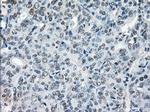 XRCC4 Antibody in Immunohistochemistry (Paraffin) (IHC (P))