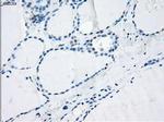 LTA4H Antibody in Immunohistochemistry (Paraffin) (IHC (P))