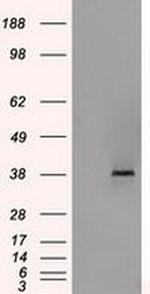 Sorbitol Dehydrogenase Antibody in Western Blot (WB)