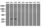 Sorbitol Dehydrogenase Antibody in Western Blot (WB)