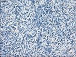 BCKDK Antibody in Immunohistochemistry (Paraffin) (IHC (P))