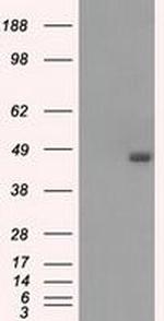 BCKDK Antibody in Western Blot (WB)