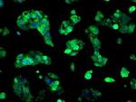 Sorbitol Dehydrogenase Antibody in Immunocytochemistry (ICC/IF)