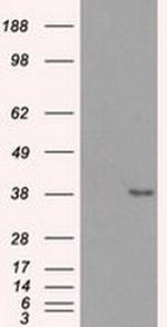 Sorbitol Dehydrogenase Antibody in Western Blot (WB)