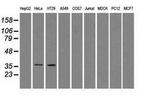 Sorbitol Dehydrogenase Antibody in Western Blot (WB)