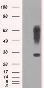 RNF144B Antibody in Western Blot (WB)