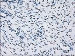 ID3 Antibody in Immunohistochemistry (Paraffin) (IHC (P))