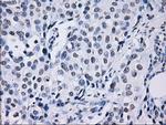 ID3 Antibody in Immunohistochemistry (Paraffin) (IHC (P))