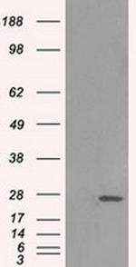 ERAB Antibody in Western Blot (WB)