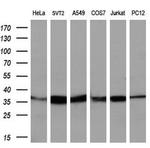 IDH3A Antibody in Western Blot (WB)