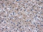 AKR1A1 Antibody in Immunohistochemistry (Paraffin) (IHC (P))